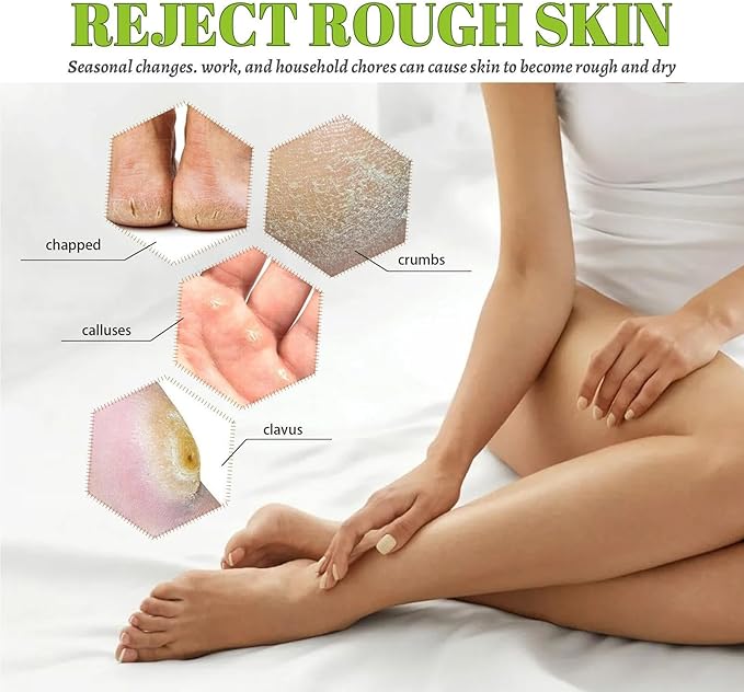 South Moon - 42% Urea Feet Cream (Original)