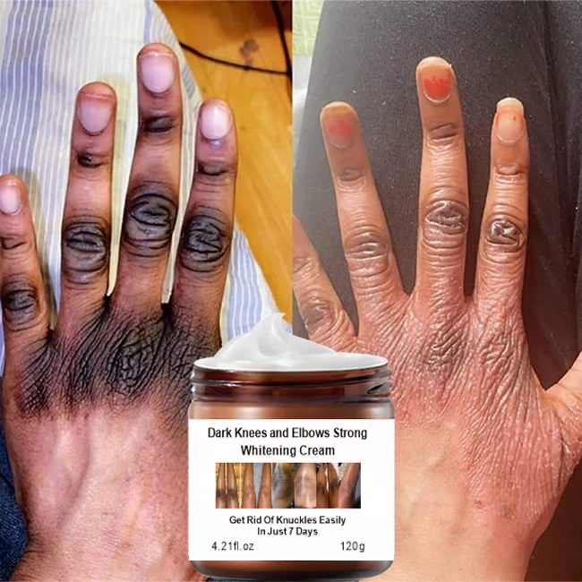 Whitening Cream- Mooyam  (Original)