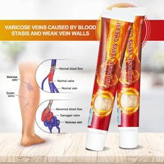 Varicose Veins Cream for pain relief,swelling-Sumifun (Original)