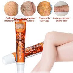 Varicose Veins Cream for pain relief,swelling-Sumifun (Original)